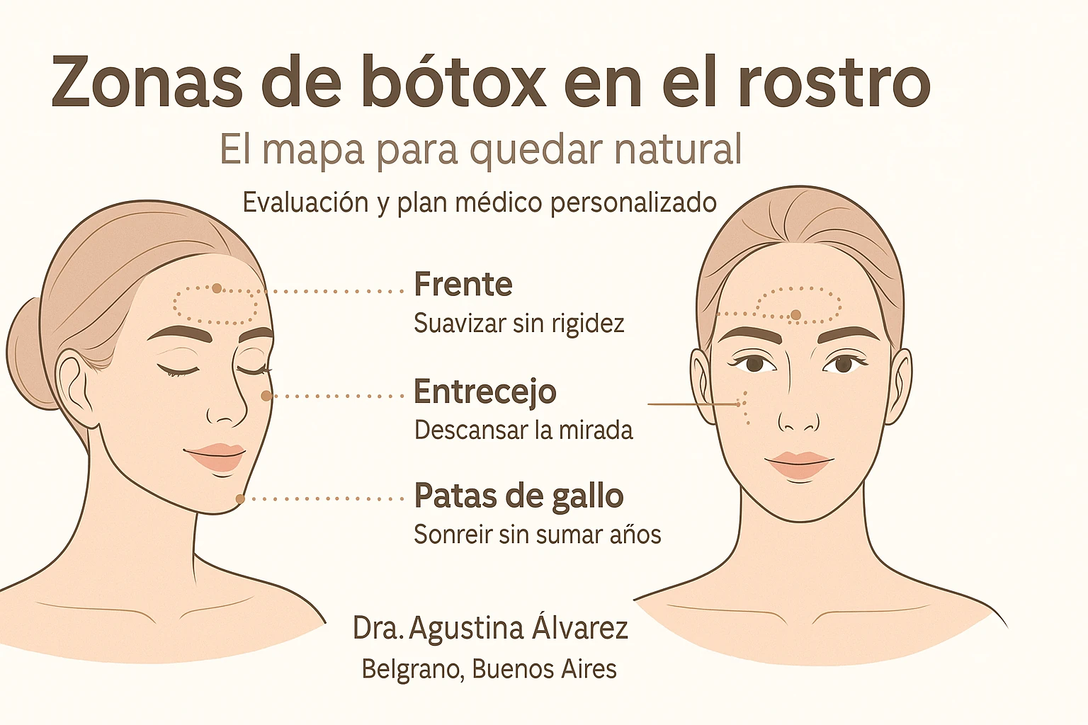 Zonas de bótox en el rostro: guía para un resultado natural