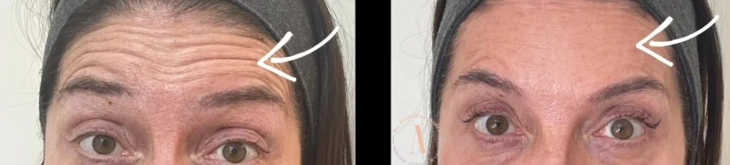 Patient with facial lines and expression assessment