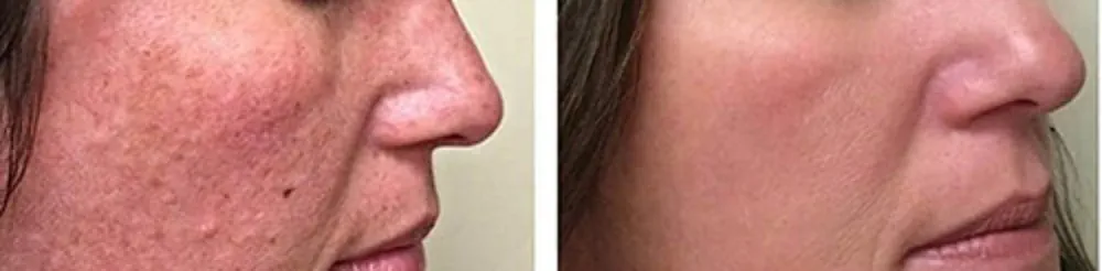 Scars concern assessment