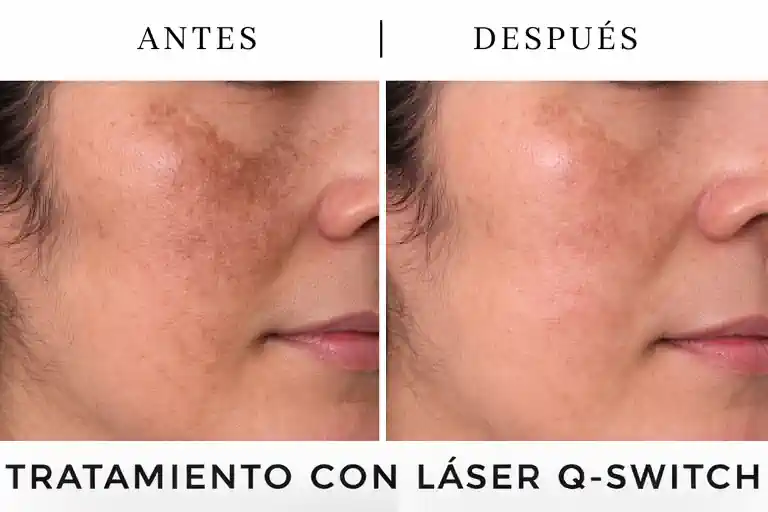 Dark spots concern assessment