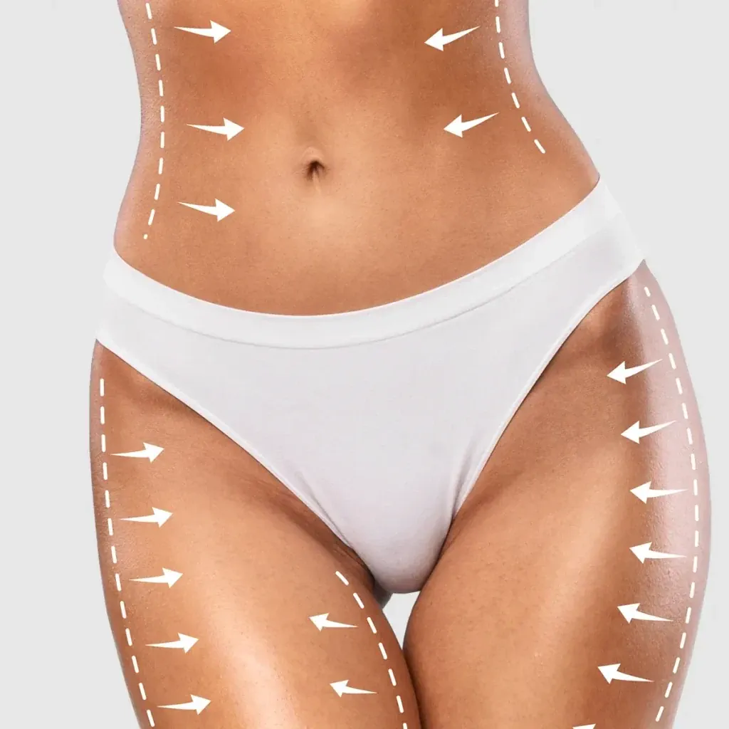 Localized fat concern assessment