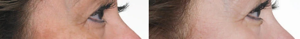 Patient with under-eye concern assessment
