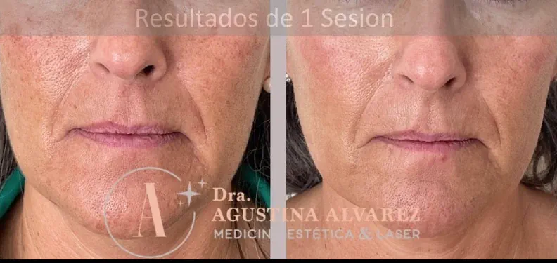 Sun damage treatment planning
