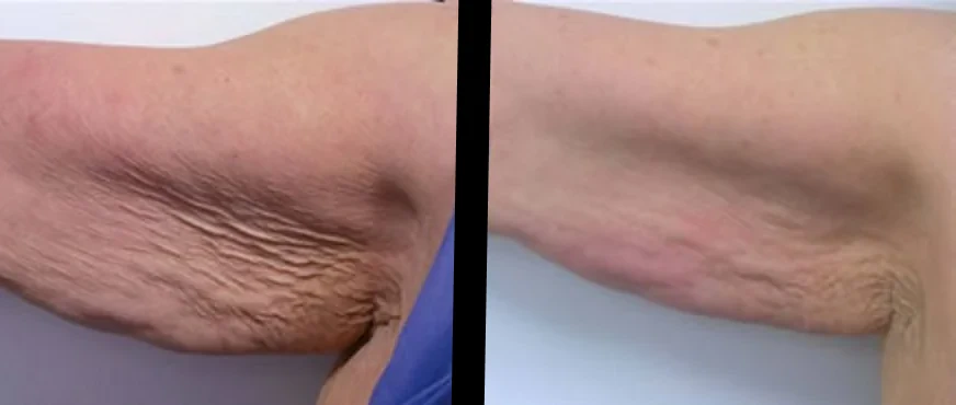 Body laxity concern assessment