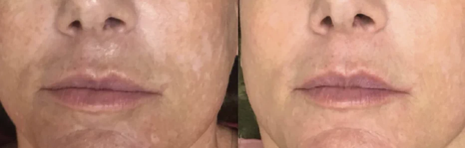 Sun damage concern assessment