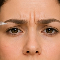 Botox Entrecejo