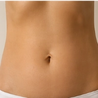 Sculptra Abdomen